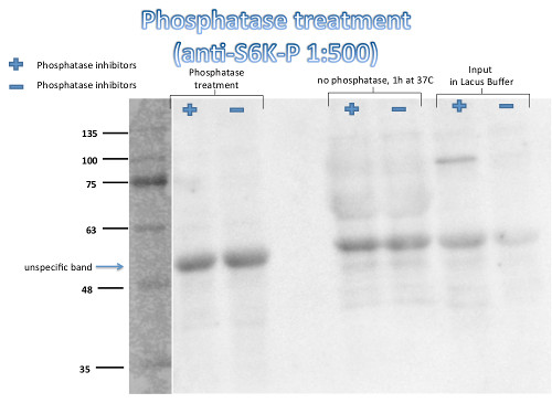 western blot using anti-S6K1-2 | Ribosomal-protein S6 kinase homolog 1,2 - phosphorylated antibodies
